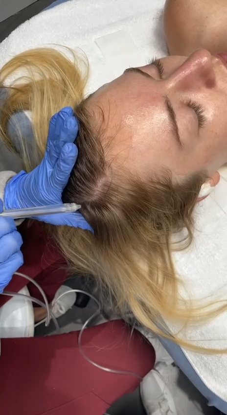 JetPeel Needleless